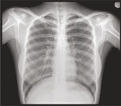 X-Ray Machine